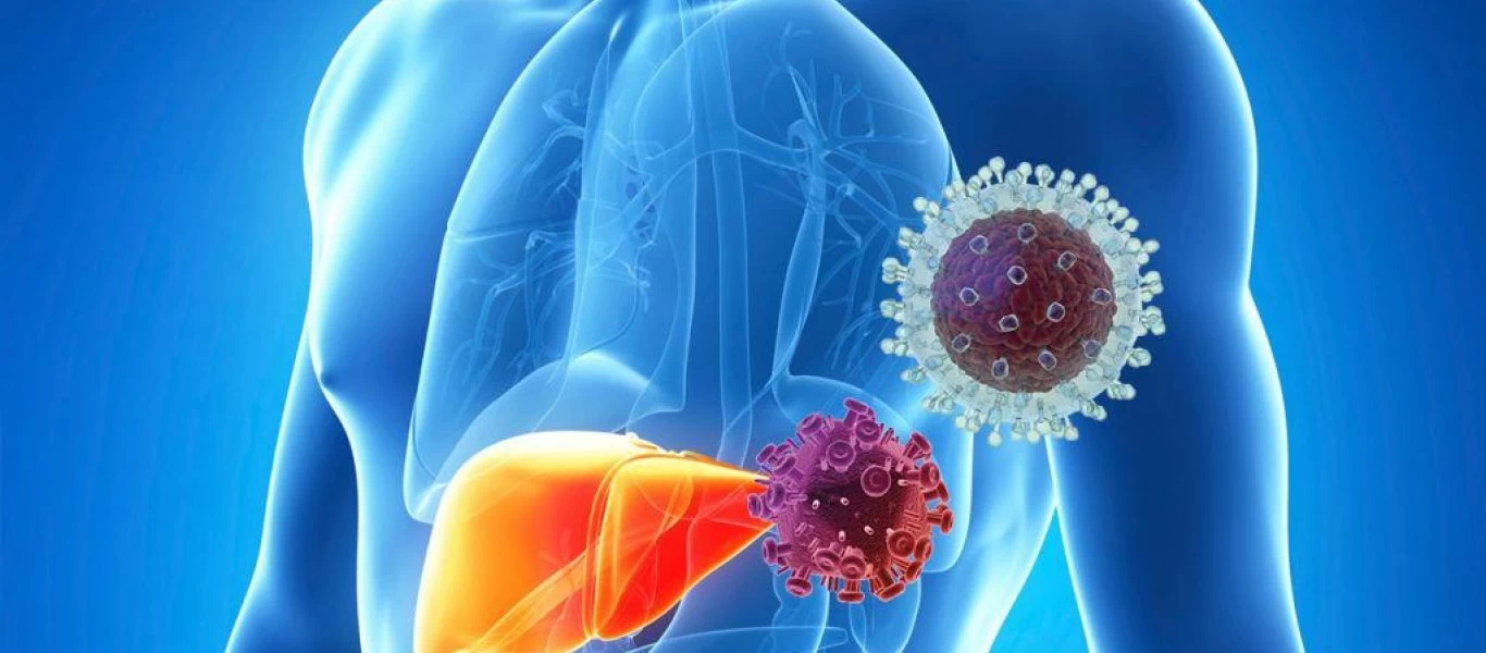 Ηπατίτιδα C: Δείτε τι κάνει στο ήπαρ - Ποια τα συμπτώματα και ποιοι κινδυνεύουν (βίντεο)